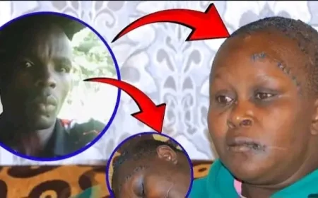 Mercy Kwamboka was cut on her head several times by her husband whom she has been living with.