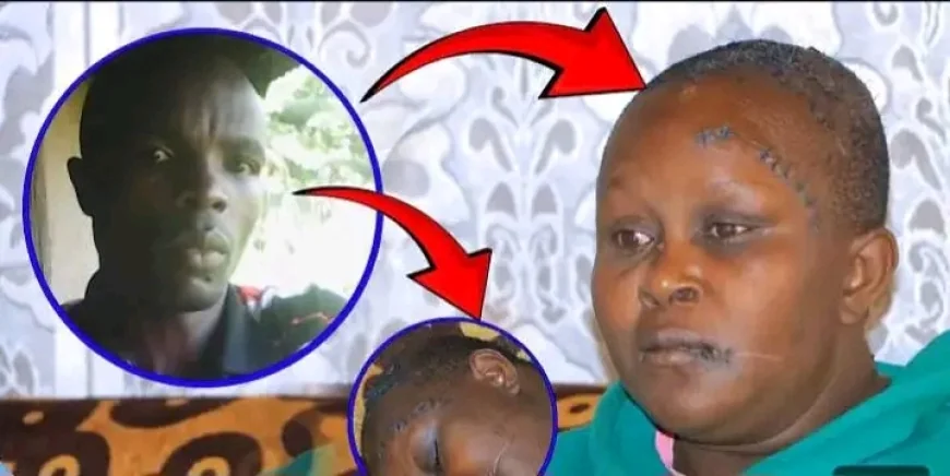 Mercy Kwamboka was cut on her head several times by her husband whom she has been living with.